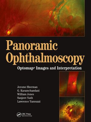 cover image of Panoramic Ophthalmoscopy